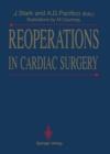 Image for Reoperations in Cardiac Surgery
