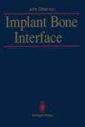 Image for Implant Bone Interface