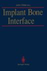 Image for Implant Bone Interface
