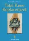 Image for Total Knee Replacement