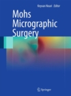 Image for Mohs Micrographic Surgery