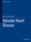 Image for Valvular Heart Disease : 0