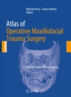 Image for Atlas of operative maxillofacial trauma surgery: primary repair of facial injuries