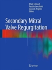 Image for Secondary Mitral Valve Regurgitation