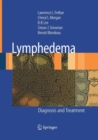 Image for Lymphedema : Diagnosis and Treatment