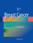 Image for Breast Cancer : A Lobar Disease