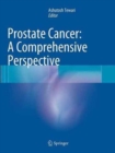 Image for Prostate Cancer: A Comprehensive Perspective