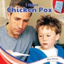 Image for I Have Chicken Pox