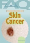 Image for Frequently Asked Questions About Skin Cancer