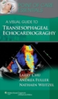 Image for A Visual Guide to Transesophageal Echocardiography
