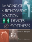 Image for Imaging of orthopaedic fixation devices and prostheses