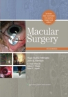 Image for Macular surgery
