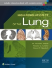 Image for High-Resolution CT of the Lung