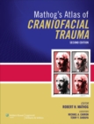 Image for Mathog&#39;s atlas of craniofacial trauma