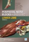 Image for Peripheral Nerve Blocks on DVD Version 3-lower Limbs for PC