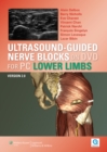 Image for Ultrasound-guided Nerve Blocks on DVD Vs 2.0: Lower Limbs for PC
