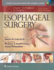 Image for Esophageal surgery