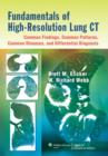 Image for Fundamentals of high-resolution lung CT  : common findings, common patterns, common diseases, and differential diagnosis
