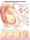 Image for Understanding Breast Cancer 3E Laminated