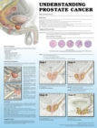Image for Understanding Prostate Cancer 2e Paper
