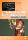 Image for Ultrasound-guided Nerve Blocks on DVD Vs 2.0 : Lower Limbs for MAC