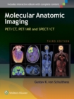 Image for Molecular anatomic imaging  : PET-CT, PET-MR, and SPECT-CT