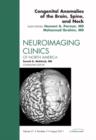 Image for Congenital Anomalies of the Brain, Spine, and Neck, An Issue of Neuroimaging Clinics