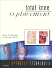 Image for Total knee replacement