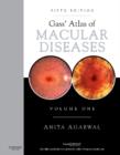 Image for Gass&#39; atlas of macular diseases.