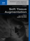 Image for Soft tissue augmentation