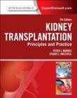 Image for Kidney transplantation  : principles and practice
