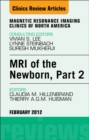 Image for MRI of the newborn.