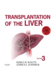Image for Transplantation of the liver