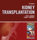 Image for Kidney transplantation: principles and practice.