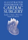 Image for Illustrated Handbook of Cardiac Surgery