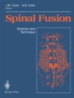Image for Spinal Fusion: Science and Technique