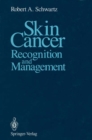 Image for Skin Cancer: Recognition and Management
