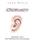 Image for Otoplasty