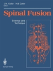Image for Spinal Fusion