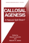 Image for Callosal Agenesis: A Natural Split Brain?
