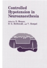 Image for Controlled Hypotension in Neuroanaesthesia