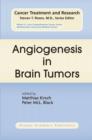 Image for Angiogenesis in Brain Tumors