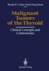 Image for Malignant Tumors of the Thyroid