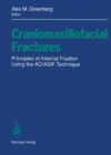 Image for Craniomaxillofacial Fractures