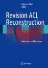Image for Revision ACL Reconstruction