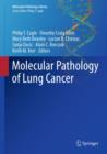 Image for Molecular pathology of lung cancer