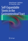 Image for Self-expandable stents in the gastrointestinal tract