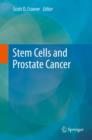 Image for Stem cells and prostate cancer
