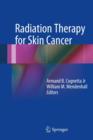 Image for Radiation therapy for skin cancer