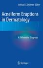 Image for Acneiform Eruptions in Dermatology